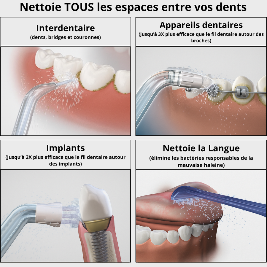 Hydropulseur Dentaire pour un Sourire Éclatant